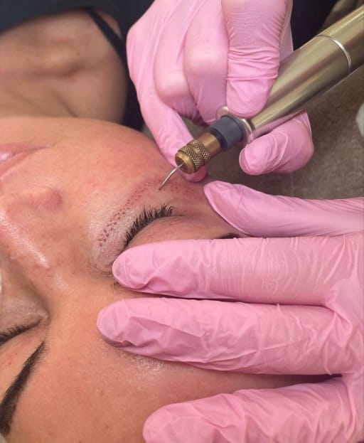 Huidbehandelingen bij Nouvelle Cosmétique