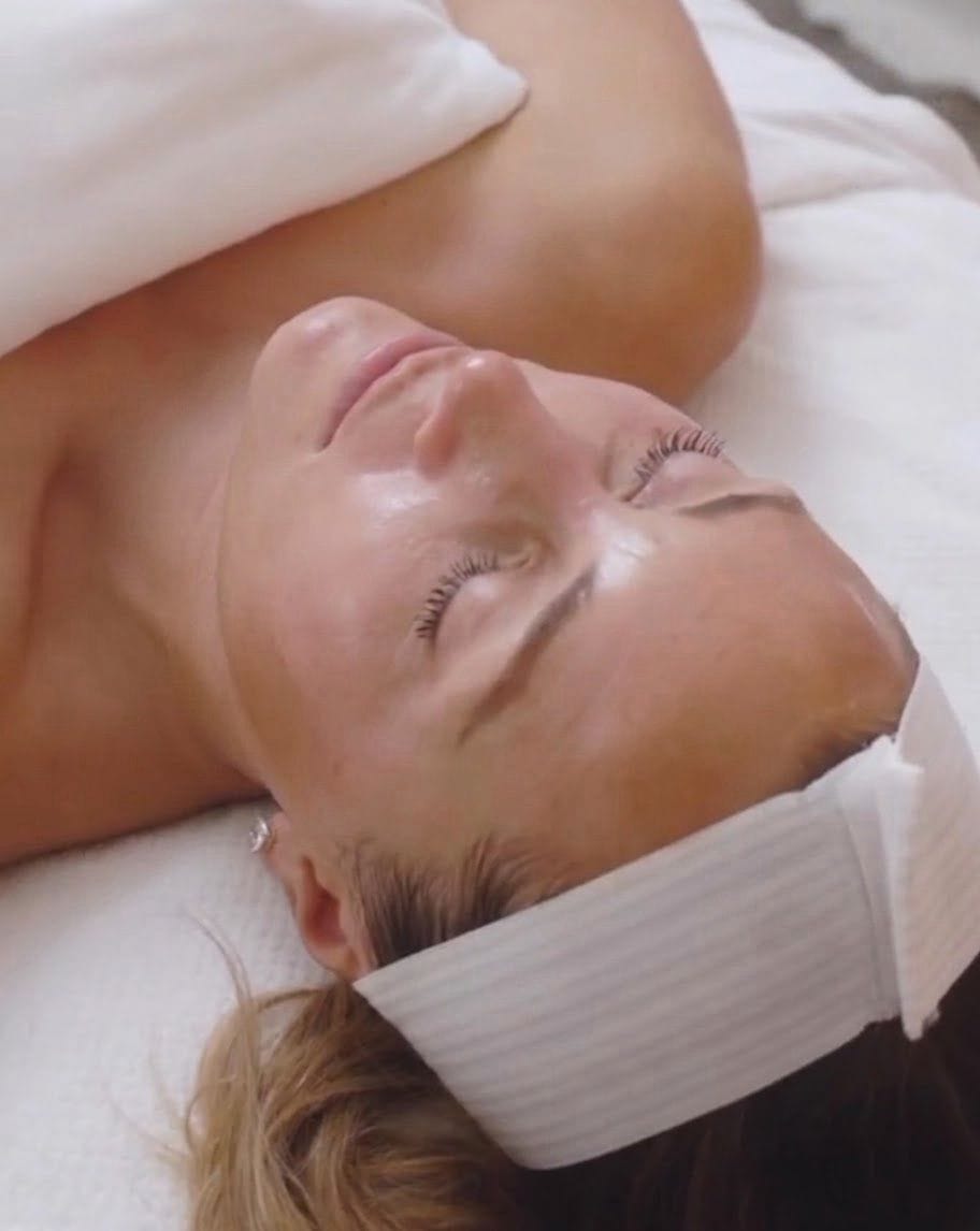 Glow Peel behandeling