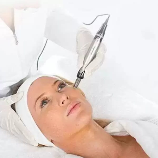 microneedling